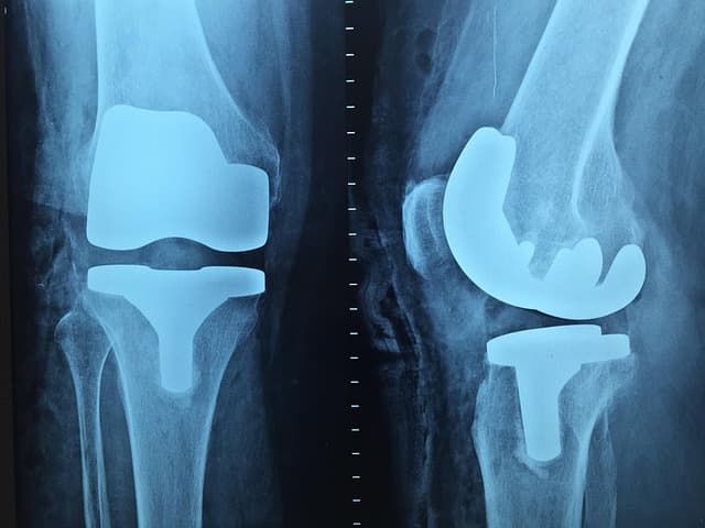 leg X-ray